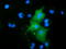 RB Binding Protein 9, Serine Hydrolase antibody, TA501740, Origene, Immunofluorescence image 
