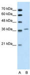 Aminolevulinate Dehydratase antibody, TA346148, Origene, Western Blot image 