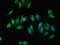 Chromosome 12 Open Reading Frame 60 antibody, LS-C377762, Lifespan Biosciences, Immunofluorescence image 