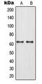 Max-binding protein MNT antibody, MBS822012, MyBioSource, Western Blot image 