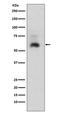 Mothers against decapentaplegic homolog 1 antibody, M00728-1, Boster Biological Technology, Western Blot image 