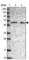 PHD Finger Protein 8 antibody, NBP1-83079, Novus Biologicals, Western Blot image 