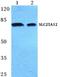 Solute Carrier Family 25 Member 12 antibody, A04746-1, Boster Biological Technology, Western Blot image 