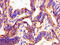 Pentraxin-related protein PTX3 antibody, CSB-PA019079LA01HU, Cusabio, Immunohistochemistry paraffin image 
