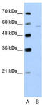 Solute carrier family 22 member 7 antibody, TA346435, Origene, Western Blot image 