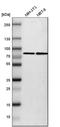 SET Domain Containing 3, Actin Histidine Methyltransferase antibody, HPA003591, Atlas Antibodies, Western Blot image 