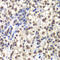 Centromere Protein C antibody, 22-310, ProSci, Immunohistochemistry frozen image 