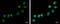 TP53 Target 5 antibody, GTX118881, GeneTex, Immunocytochemistry image 