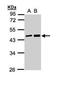 MAGE Family Member A11 antibody, TA308233, Origene, Western Blot image 
