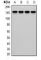 Protein diaphanous homolog 1 antibody, orb340970, Biorbyt, Western Blot image 