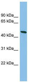 Casein Kinase 1 Gamma 2 antibody, TA340011, Origene, Western Blot image 
