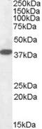Laforin antibody, orb20119, Biorbyt, Western Blot image 