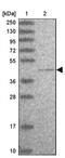 Chromosome 19 Open Reading Frame 47 antibody, PA5-61210, Invitrogen Antibodies, Western Blot image 