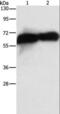 Alkaline Phosphatase, Placental antibody, LS-C401423, Lifespan Biosciences, Western Blot image 