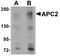 Anaphase Promoting Complex Subunit 2 antibody, A02624, Boster Biological Technology, Western Blot image 