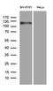 Amyloid beta A4 precursor protein-binding family B member 1 antibody, LS-C795844, Lifespan Biosciences, Western Blot image 