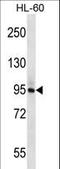 Phospholipase C Delta 1 antibody, LS-C163775, Lifespan Biosciences, Western Blot image 