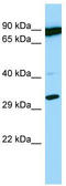 Proteasome Subunit Beta 11 antibody, TA334356, Origene, Western Blot image 