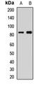 Centrosomal protein of 83 kDa antibody, LS-C668757, Lifespan Biosciences, Western Blot image 