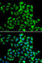 Cytoplasmic Linker Associated Protein 1 antibody, 22-683, ProSci, Immunofluorescence image 