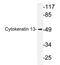 HMW Cytokeratin antibody, AP20626PU-N, Origene, Western Blot image 
