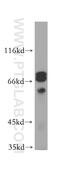 Putative Wiskott-Aldrich syndrome protein family member 4 antibody, 19755-1-AP, Proteintech Group, Western Blot image 