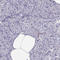 Melanoma-associated antigen C1 antibody, HPA004622, Atlas Antibodies, Immunohistochemistry frozen image 