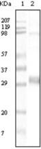 Neomycin Phosphotransferase II antibody, abx011243, Abbexa, Enzyme Linked Immunosorbent Assay image 