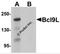 BCL9 Like antibody, 6213, ProSci, Western Blot image 