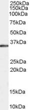 E3 ubiquitin-protein ligase CHIP antibody, 45-398, ProSci, Enzyme Linked Immunosorbent Assay image 