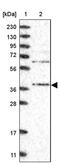 Serine-threonine kinase receptor-associated protein antibody, PA5-55583, Invitrogen Antibodies, Western Blot image 