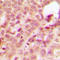 ABL Proto-Oncogene 1, Non-Receptor Tyrosine Kinase antibody, LS-C354283, Lifespan Biosciences, Immunohistochemistry frozen image 