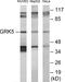 G Protein-Coupled Receptor Kinase 5 antibody, EKC1709, Boster Biological Technology, Western Blot image 