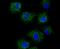Transient Receptor Potential Cation Channel Subfamily C Member 1 antibody, NBP2-75690, Novus Biologicals, Immunocytochemistry image 