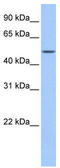 Fatty Acid Amide Hydrolase 2 antibody, TA337762, Origene, Western Blot image 