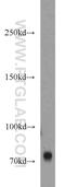 Minichromosome Maintenance Complex Component 3 Associated Protein antibody, 11054-1-AP, Proteintech Group, Western Blot image 