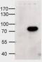 ATP Binding Cassette Subfamily D Member 1 antibody, GTX88645, GeneTex, Western Blot image 