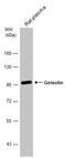 Gelsolin antibody, GTX101185, GeneTex, Western Blot image 