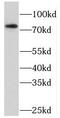 Protein kinase C delta type antibody, FNab06483, FineTest, Western Blot image 