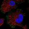 p24 antibody, NBP1-80962, Novus Biologicals, Immunocytochemistry image 