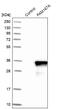 Family With Sequence Similarity 167 Member A antibody, NBP1-91236, Novus Biologicals, Western Blot image 
