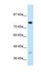 DC-STAMP Domain Containing 1 antibody, NBP1-59775, Novus Biologicals, Western Blot image 