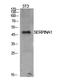 Alpha-1-antitrypsin antibody, STJ97256, St John