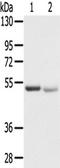 SLC8B1 antibody, TA351684, Origene, Western Blot image 