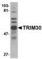 Tripartite motif-containing protein 30 antibody, MBS150718, MyBioSource, Western Blot image 