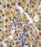Autotaxin antibody, LS-C97352, Lifespan Biosciences, Immunohistochemistry paraffin image 