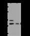 Forkhead Box M1 antibody, 204390-T42, Sino Biological, Western Blot image 
