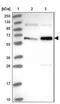 MINDY Lysine 48 Deubiquitinase 2 antibody, NBP2-14724, Novus Biologicals, Western Blot image 