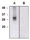Chloride intracellular channel protein 5 antibody, NBP2-62197, Novus Biologicals, Western Blot image 