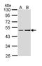 Guanine nucleotide-binding protein G(s) subunit alpha isoforms XLas antibody, LS-B4790, Lifespan Biosciences, Western Blot image 